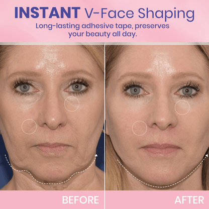V-Face Lifting Invisible Adhesive Tape 10