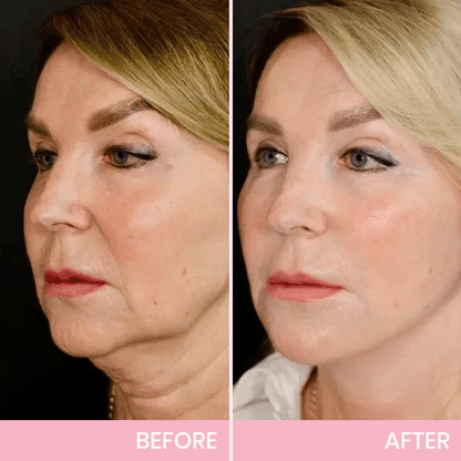 V-Face Lifting Invisible Adhesive Tape 10